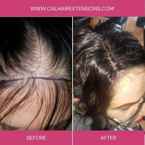 Hair Toppers